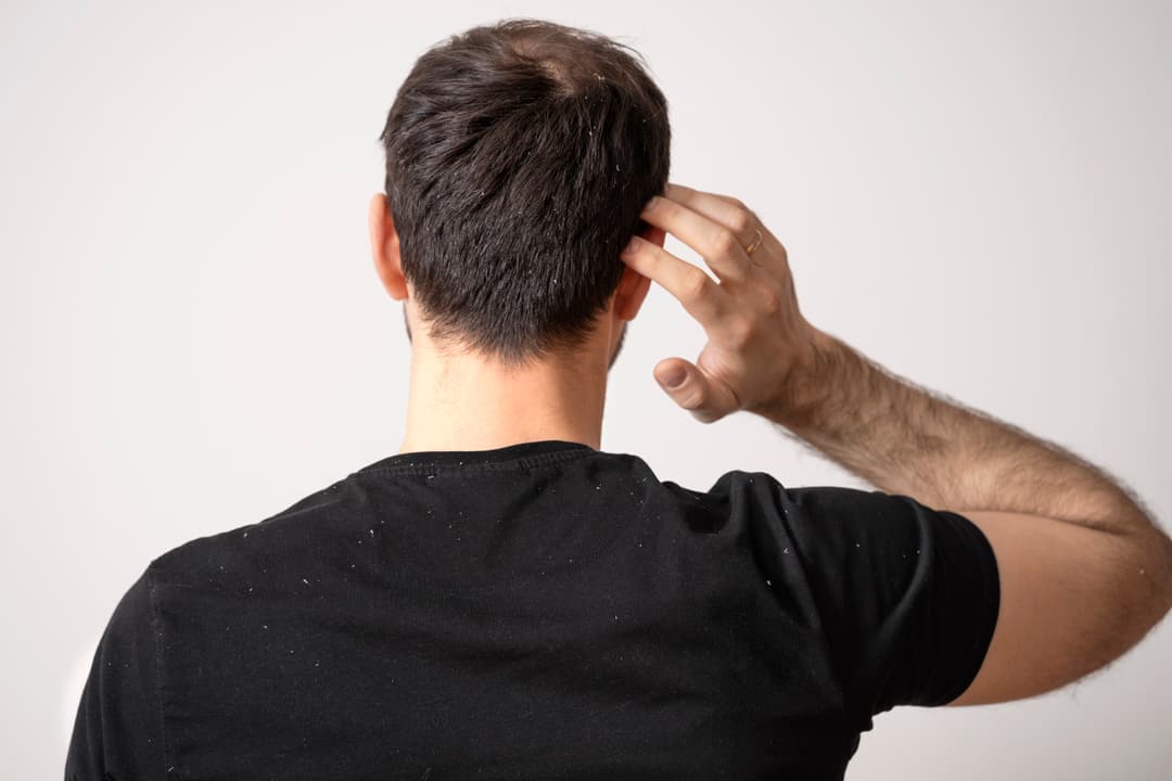 LLLT Hair Therapy