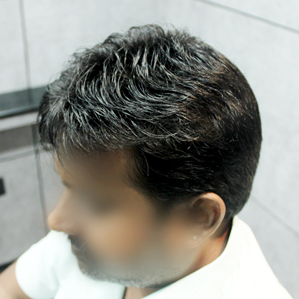 second image