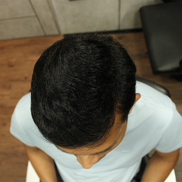 second image
