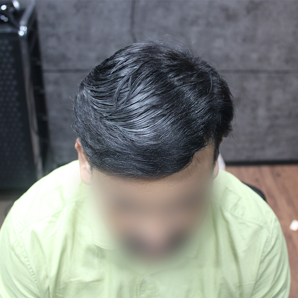 second image