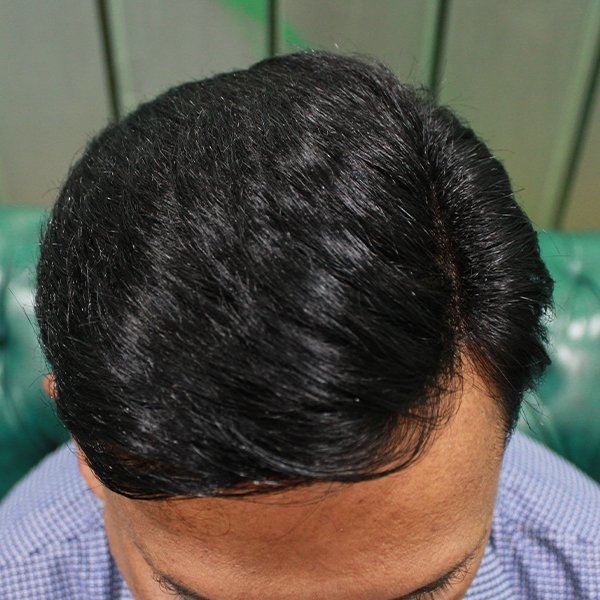 second image