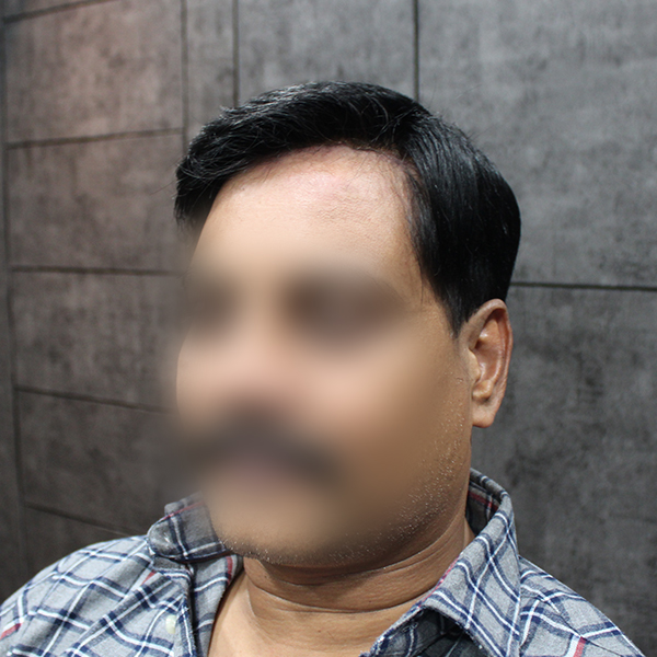 second image